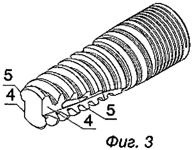 Дентальный внутрикостный имплантат и абатмент для него (патент 2441621)
