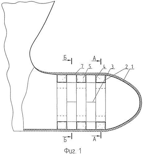 Бульбовая наделка корпуса судна (патент 2527619)