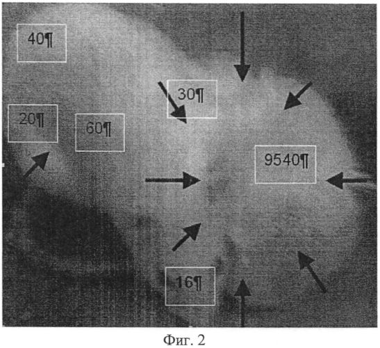 Способ ферримагнито-термохимиотерапии злокачественных опухолей комбинациями магнитоуправляемых нанопрепаратов с визуализацией онкогенеза, определением терапии, предпочтительной в режиме реального времени, и мониторингом результатов лечения в эксперименте (патент 2563369)