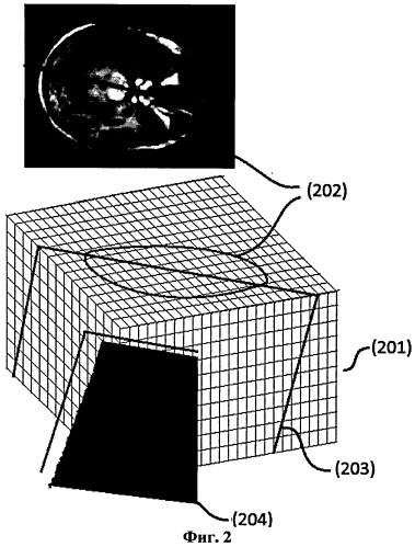 Система и способ для автоматического планирования видов в объемных изображениях мозга (патент 2523929)