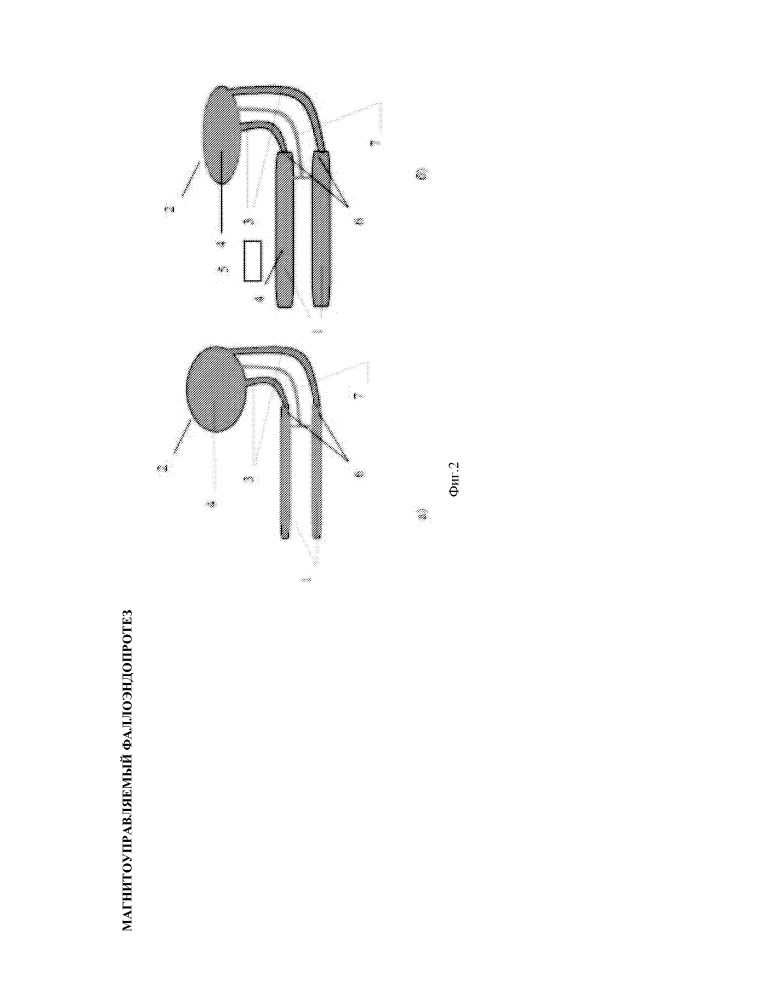 Магнитоуправляемый фаллоэндопротез (патент 2651098)