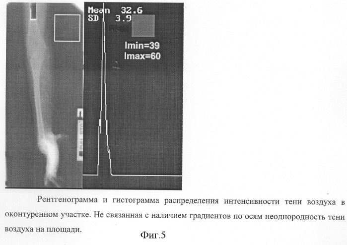 Способ фотоденситометрии рентгенограмм или их оцифрованных изображений (патент 2281030)