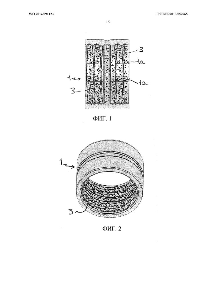 Направляющий элемент в форме металлического кольца для монтажа штифта с трением и со способностью к сочленению и/или скольжению (патент 2637077)