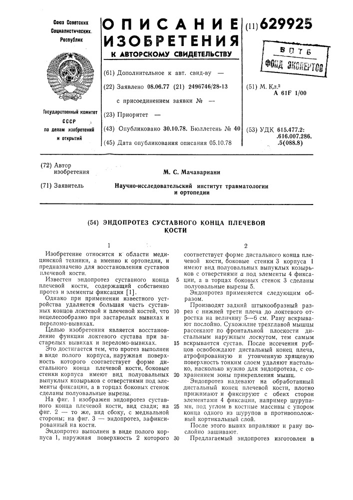 Эндопротез суставного конца плечевой кости (патент 629925)