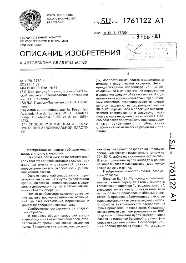 Способ формирования ямки пупка при абдоминальной пластике (патент 1761122)