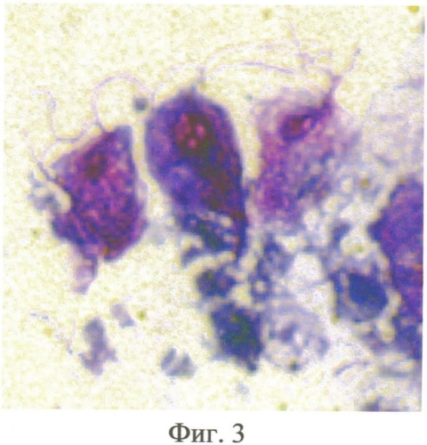 Способ выявления форм урогенитальных трихомонад (патент 2553307)