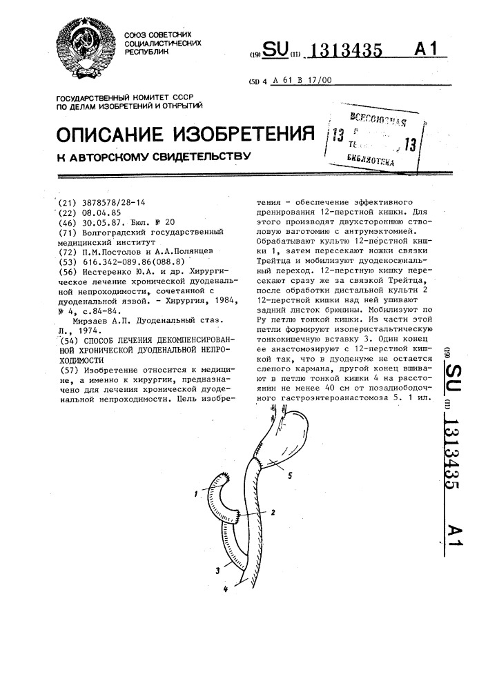 Способ лечения декомпенсированной хронической дуоденальной непроходимости (патент 1313435)