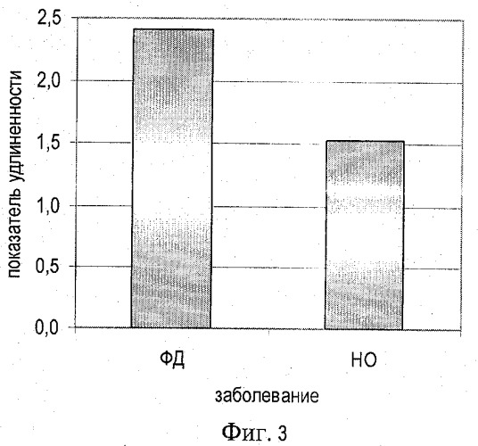 Способ оценки гипопластических состояний костной ткани (патент 2340894)