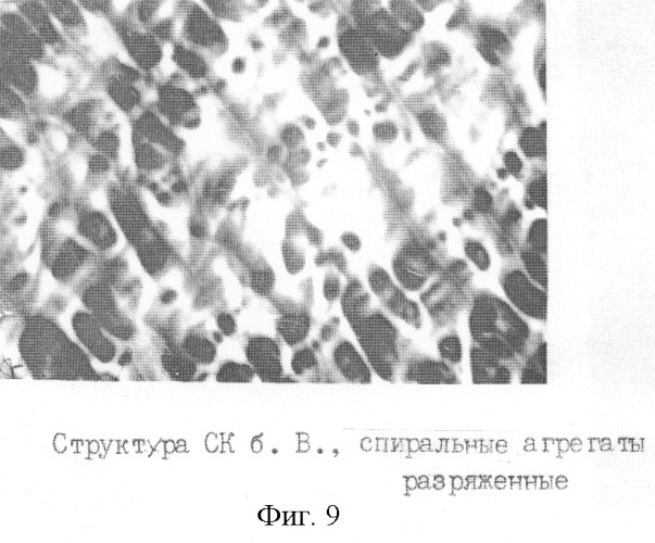 Способ экспресс-диагностики гипер-бета 2-микроглобулинемии (патент 2259565)