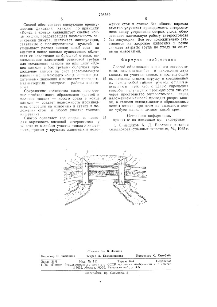 Способ образования внешнего энтеро-стомоза (патент 793569)