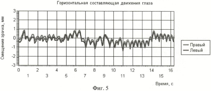 Способ подавления нистагма глаз движущимися полосами (патент 2447865)