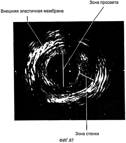 Устройство для локальной и/или регионарной доставки с применением жидких составов терапевтически активных веществ (патент 2513153)