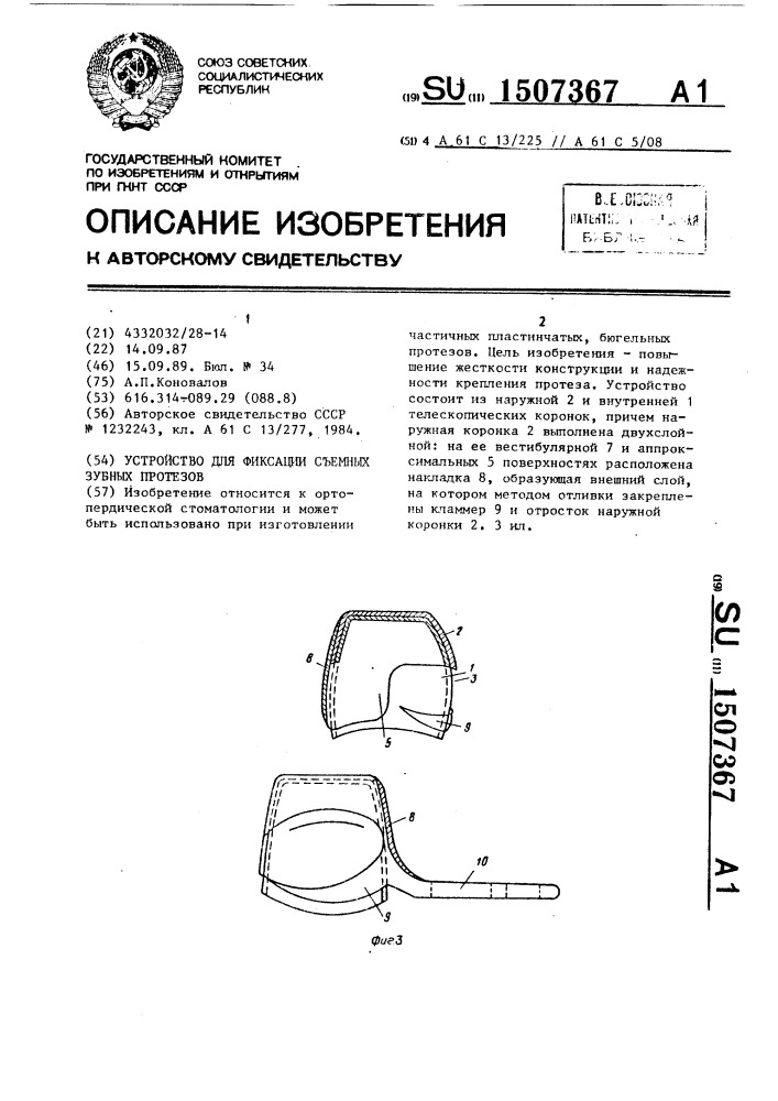 Устройство для фиксации съемных зубных протезов (патент 1507367)