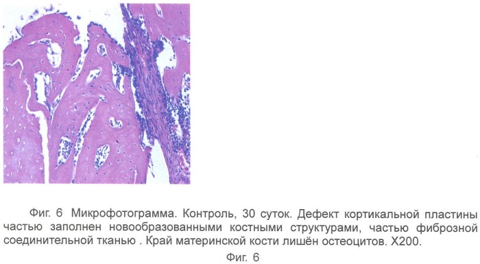 Гель для регенерации костной ткани (патент 2360663)