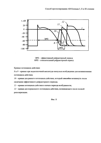 Способ прогнозирования ав-блокады i, ii и iii степени (патент 2591839)