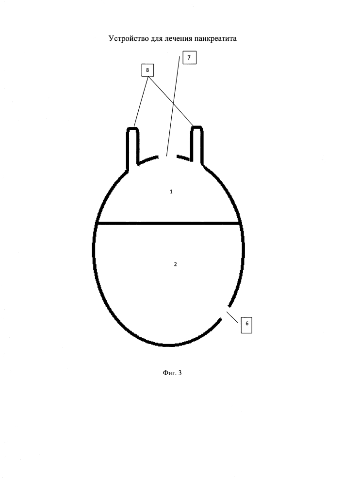 Устройство для лечения панкреатита (патент 2607929)