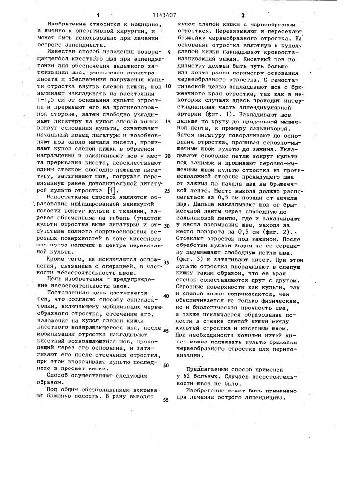 Способ аппендэктомии (патент 1143407)