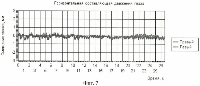 Способ подавления нистагма глаз движущимися полосами (патент 2447865)