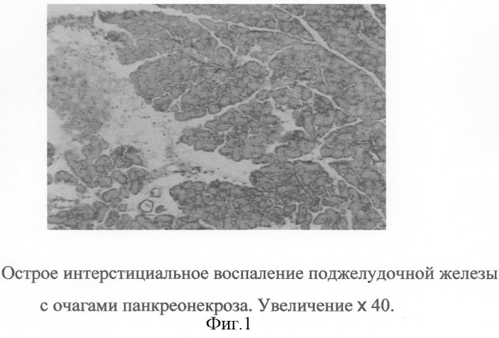 Способ моделирования острого некротического панкреатита (патент 2286608)