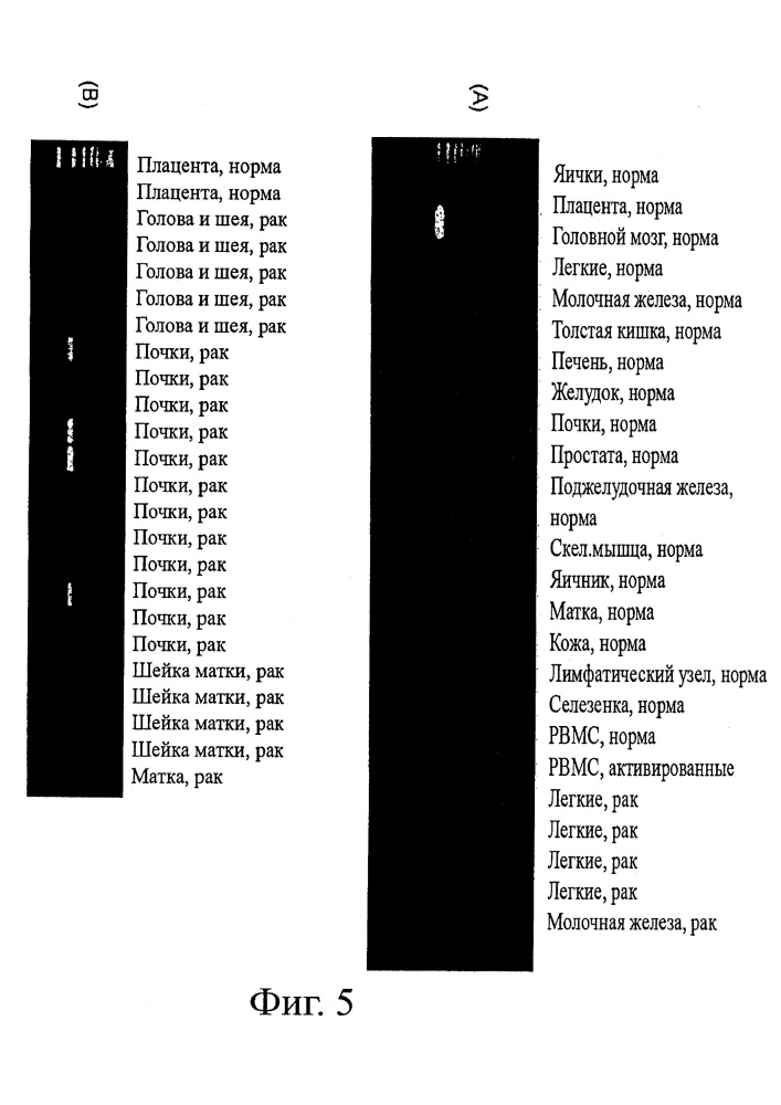 Идентификация опухолеассоциированных антигенов для диагностики и терапии (патент 2644686)