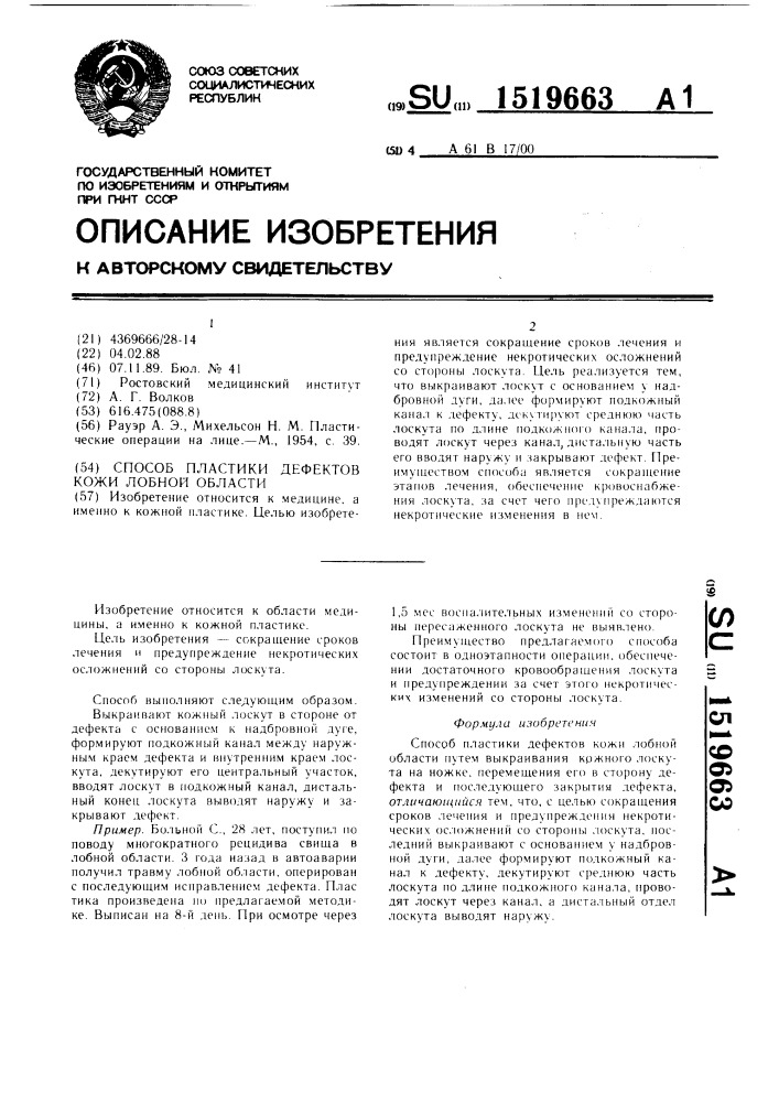 Способ пластики дефектов кожи лобной области (патент 1519663)