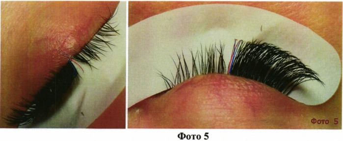 Способ наращивания ресниц "lash-to-lash" (патент 2541953)