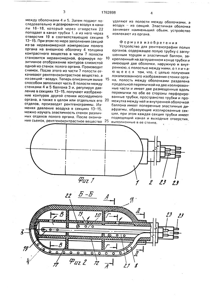 Устройство для рентгенографии полых органов (патент 1762898)