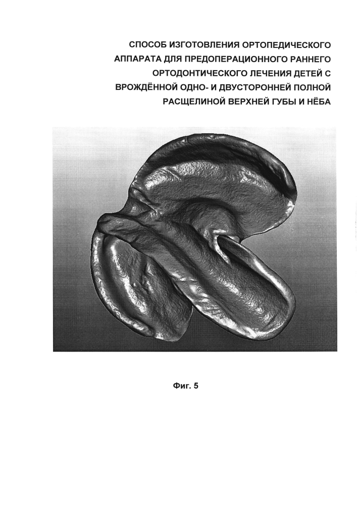 Способ изготовления ортопедического аппарата для предоперационного раннего ортодонтического лечения детей с врождённой одно- и двусторонней полной расщелиной верхней губы и нёба (патент 2599373)