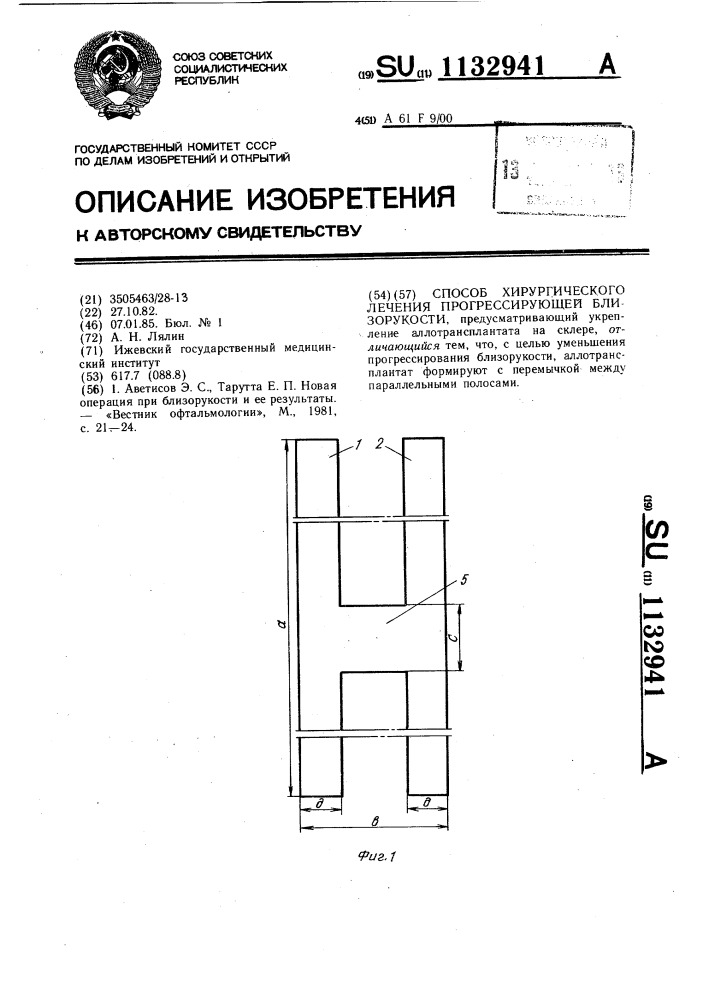 Способ хирургического лечения прогрессирующей близорукости (патент 1132941)