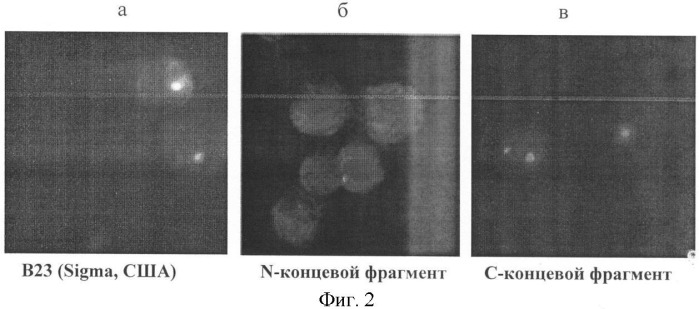 Способ иммуноцитохимической оценки пролиферативного состояния лимфоцитов по характеру экспрессии c-концевого фрагмента белка b23/нуклеофозмина в реакции непрямой иммунофлюоресценции (патент 2438135)