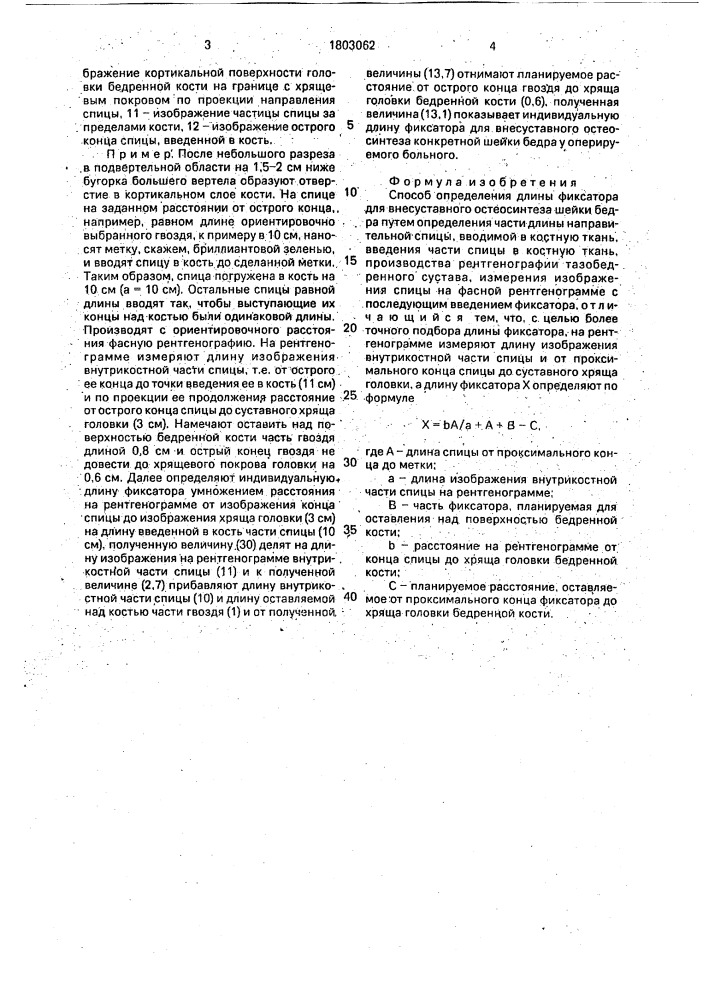Способ определения длины фиксатора для внесуставного остеосинтеза шейки бедра (патент 1803062)