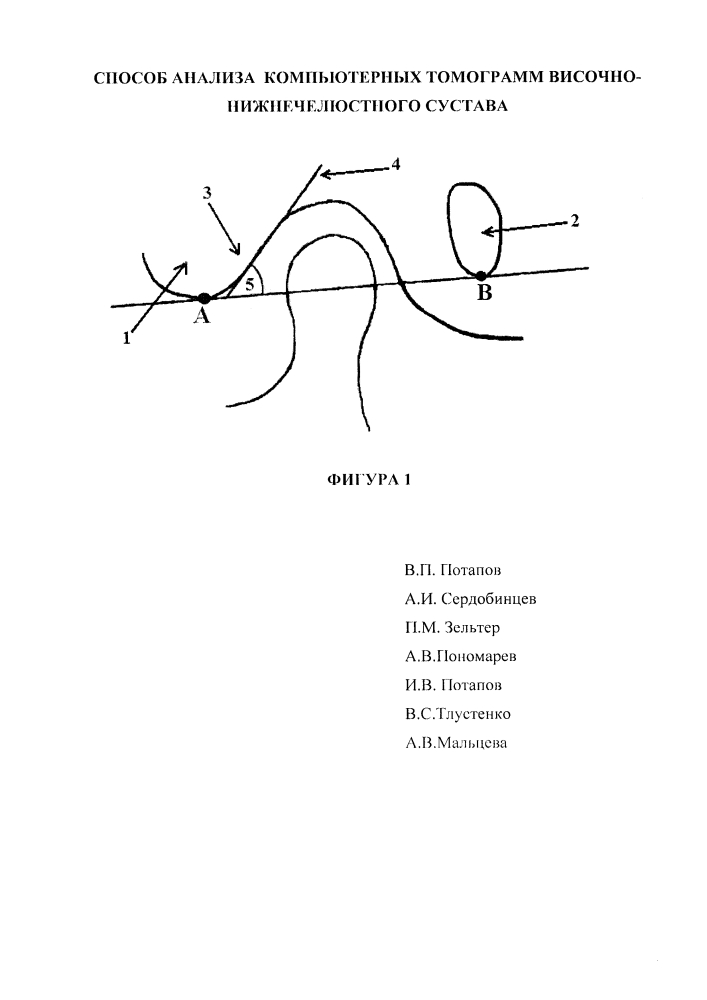 Способ анализа компьютерных томограмм височно-нижнечелюстного сустава (патент 2608704)