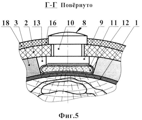 Устройство для термо- и фотохромо-ультразвукового лечения остеоартрозов (патент 2496537)