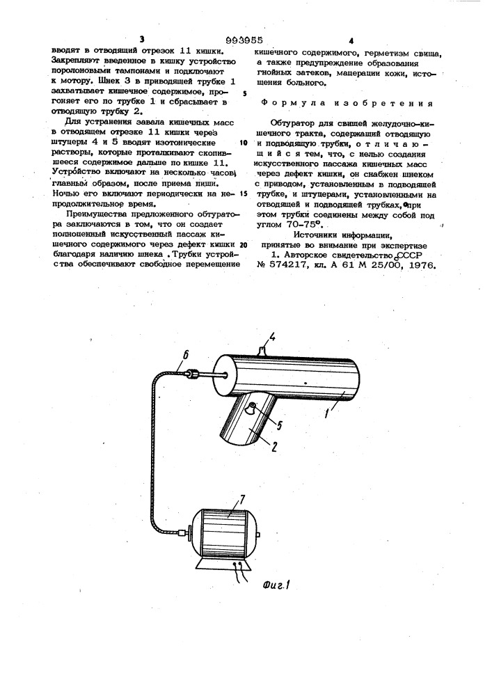 Обтуратор для свищей желудочно-кишечного тракта (патент 993955)