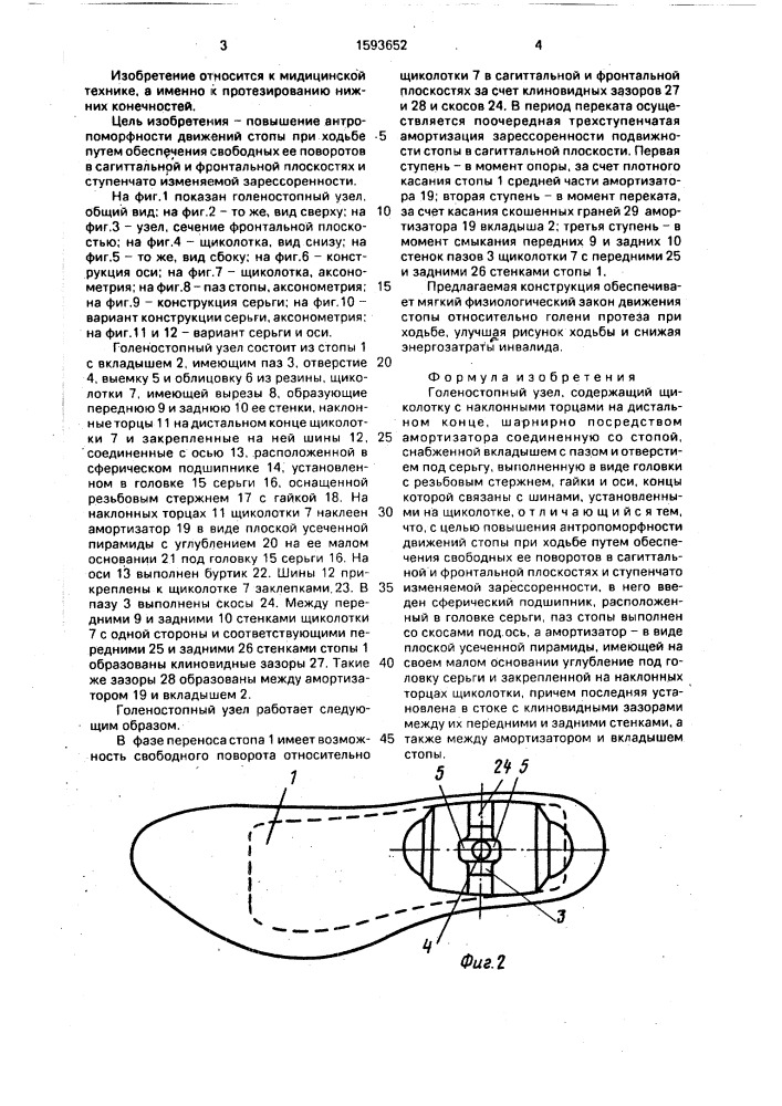 Голеностопный узел по ф.а.ткачу (патент 1593652)