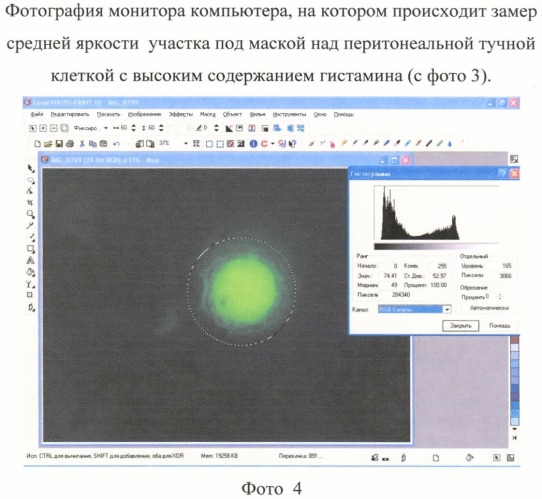 Компьютерный анализ точечных цифровых изображений гистологических препаратов для определения концентрации гистамина в биологических структурах (патент 2392845)