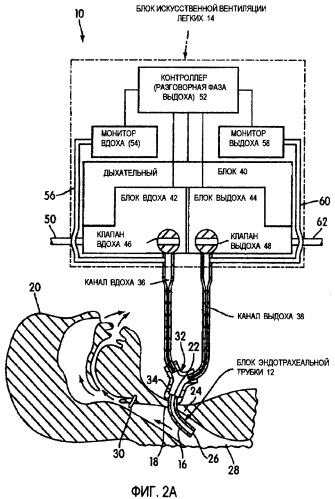 Обнаружение отклонений в системе искусственной вентиляции легких в режиме разговора (патент 2455030)