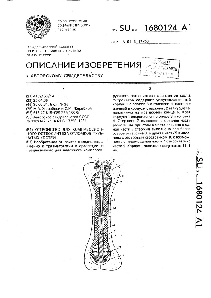 Устройство для компрессионного остеосинтеза отломков трубчатых костей (патент 1680124)