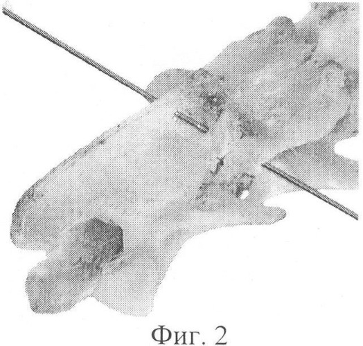 Способ остеосинтеза шейного отдела позвоночника у мелких домашних животных (патент 2328245)