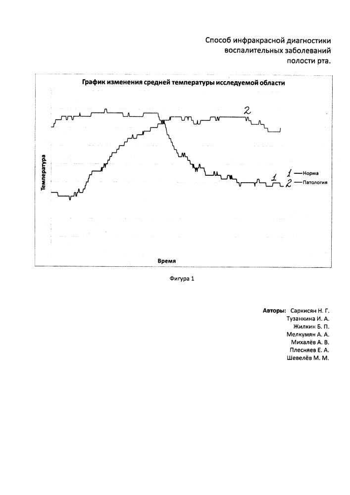Способ инфракрасной диагностики воспалительных заболеваний пародонта (патент 2612833)