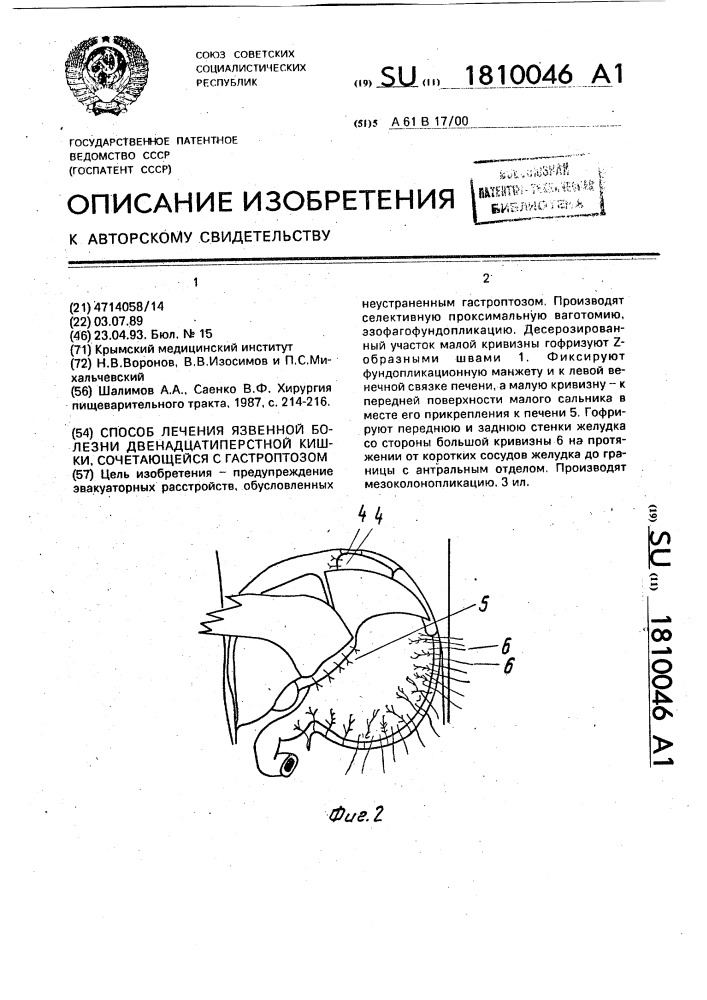 Способ лечения язвенной болезни двенадцатиперстной кишки, сочетающейся с гастроптозом (патент 1810046)