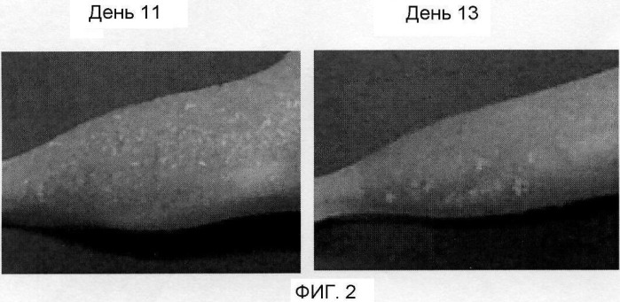Средство, потенцирующее радиационную терапию (патент 2435587)