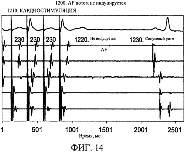 Способы, система и устройство для обнаружения, диагностики и лечения нарушений биологического ритма (патент 2556974)