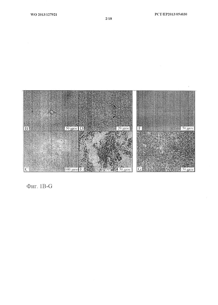 3d in vitro двухфазный костно-хрящевой конструкт (патент 2615439)