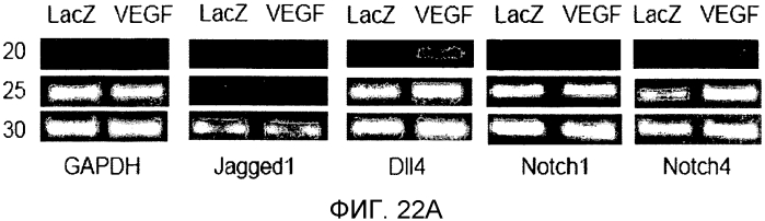 Основанные на notch3 человека гибридные белки в качестве ловушек-ингибиторов передачи сигнала notch3 (патент 2567662)