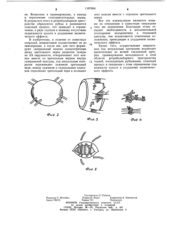 Способ образования подвижной основы для глазного протеза (патент 1197664)