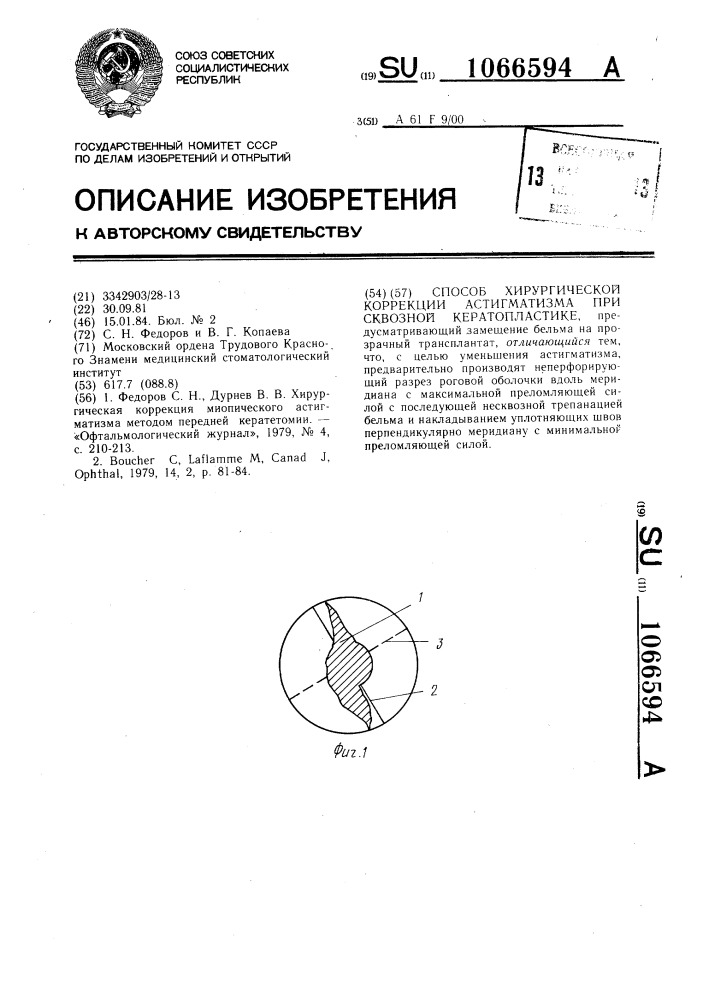 Способ хирургической коррекции астигматизма при сквозной кератопластике (патент 1066594)