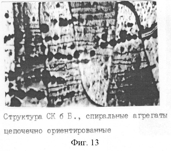 Способ экспресс-диагностики гипер-бета 2-микроглобулинемии (патент 2259565)