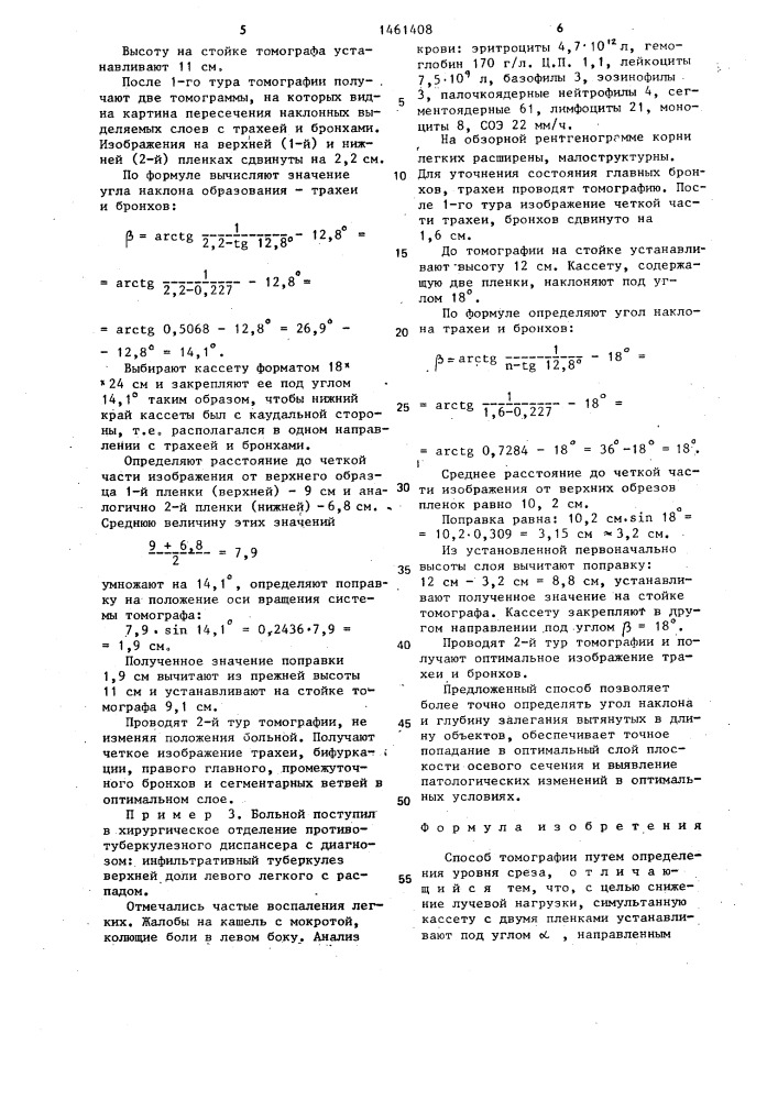 Способ томографии (патент 1461408)