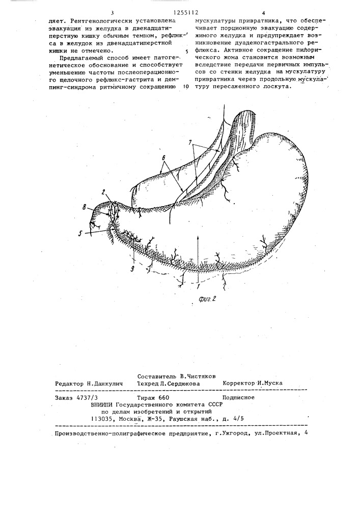 Способ хирургического лечения язвенной болезни двенадцатиперстной кишки (патент 1255112)